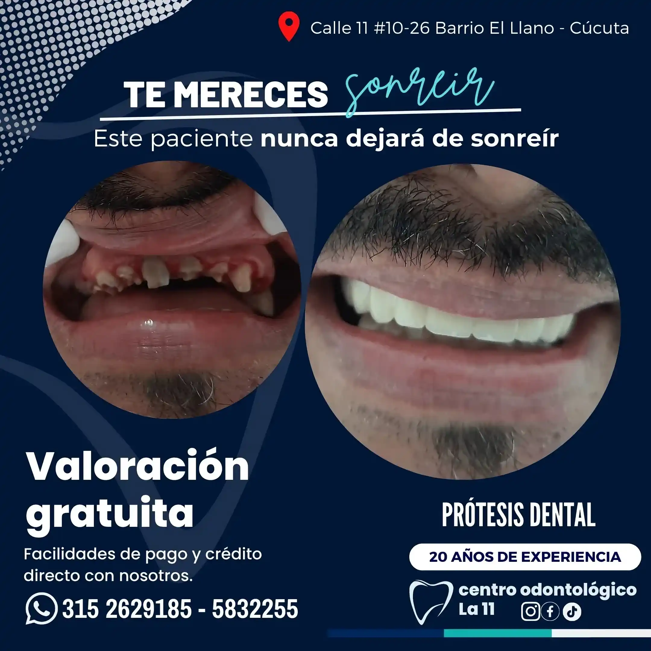 Procedimiento dental 5