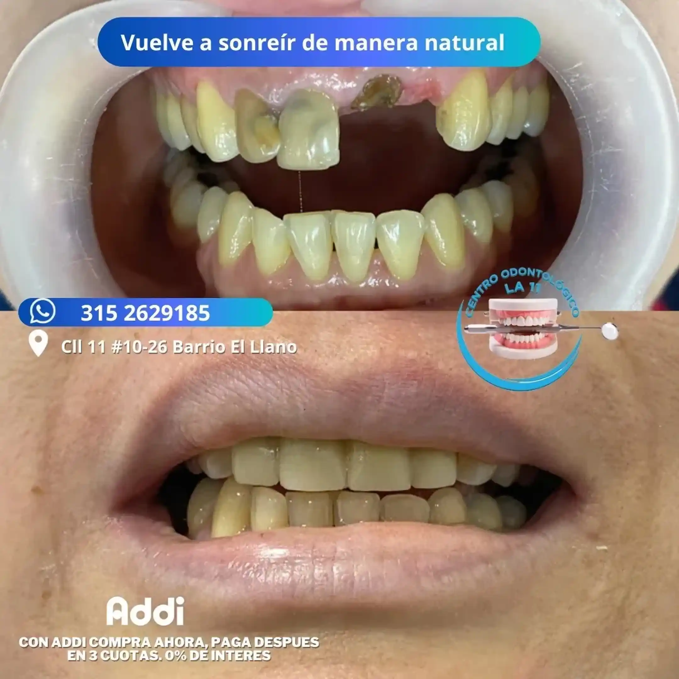 Procedimiento dental 9