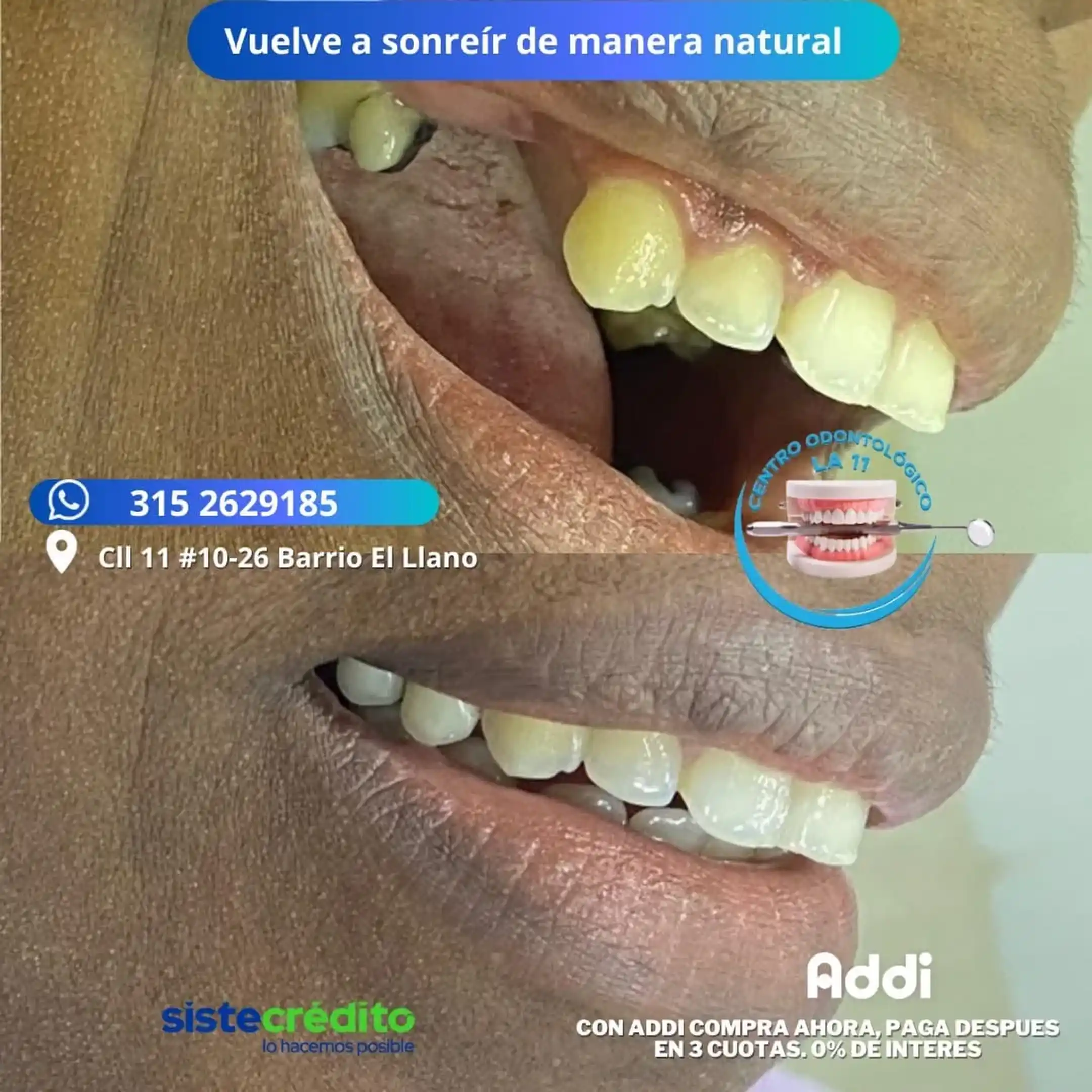 Procedimiento dental 13