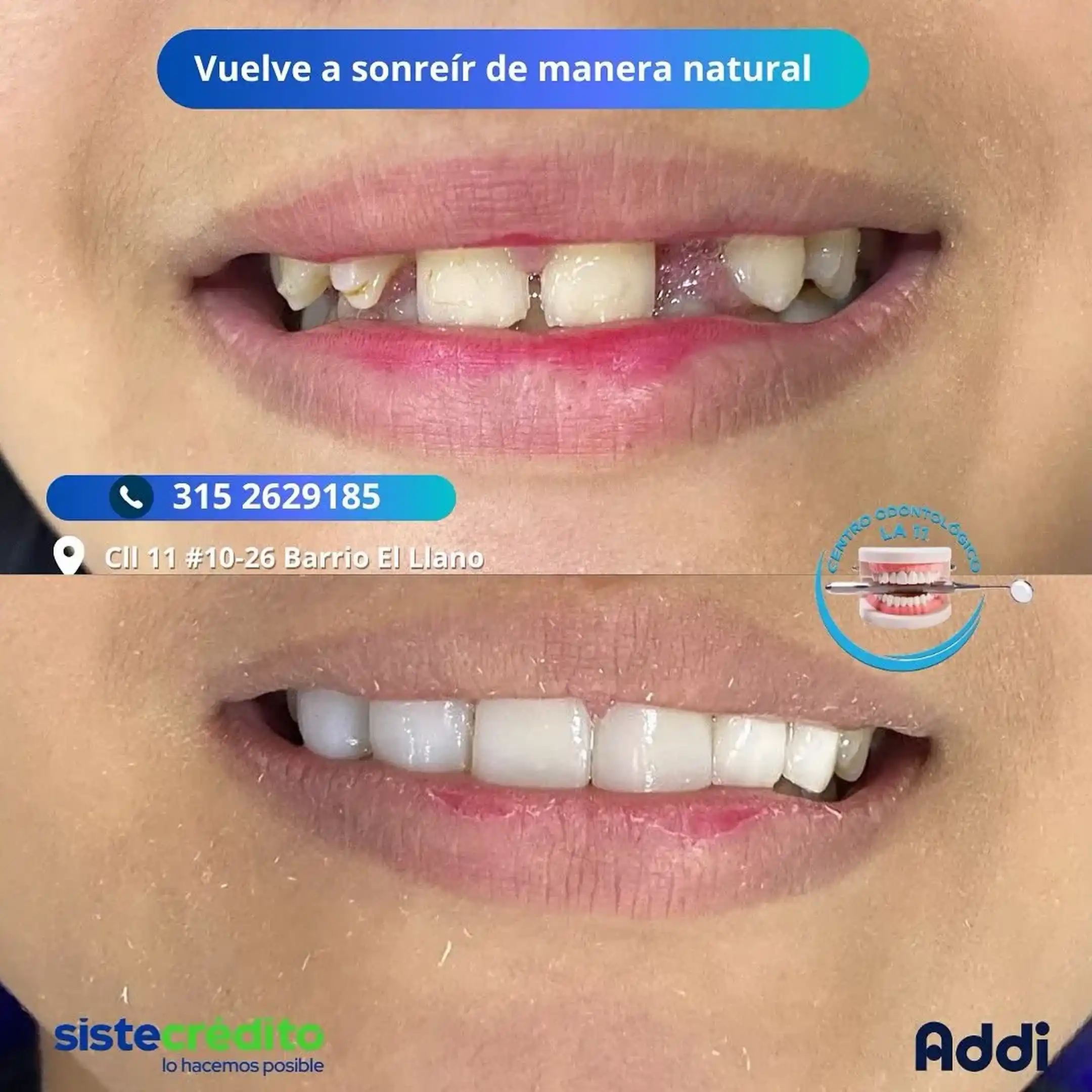 Procedimiento dental 14