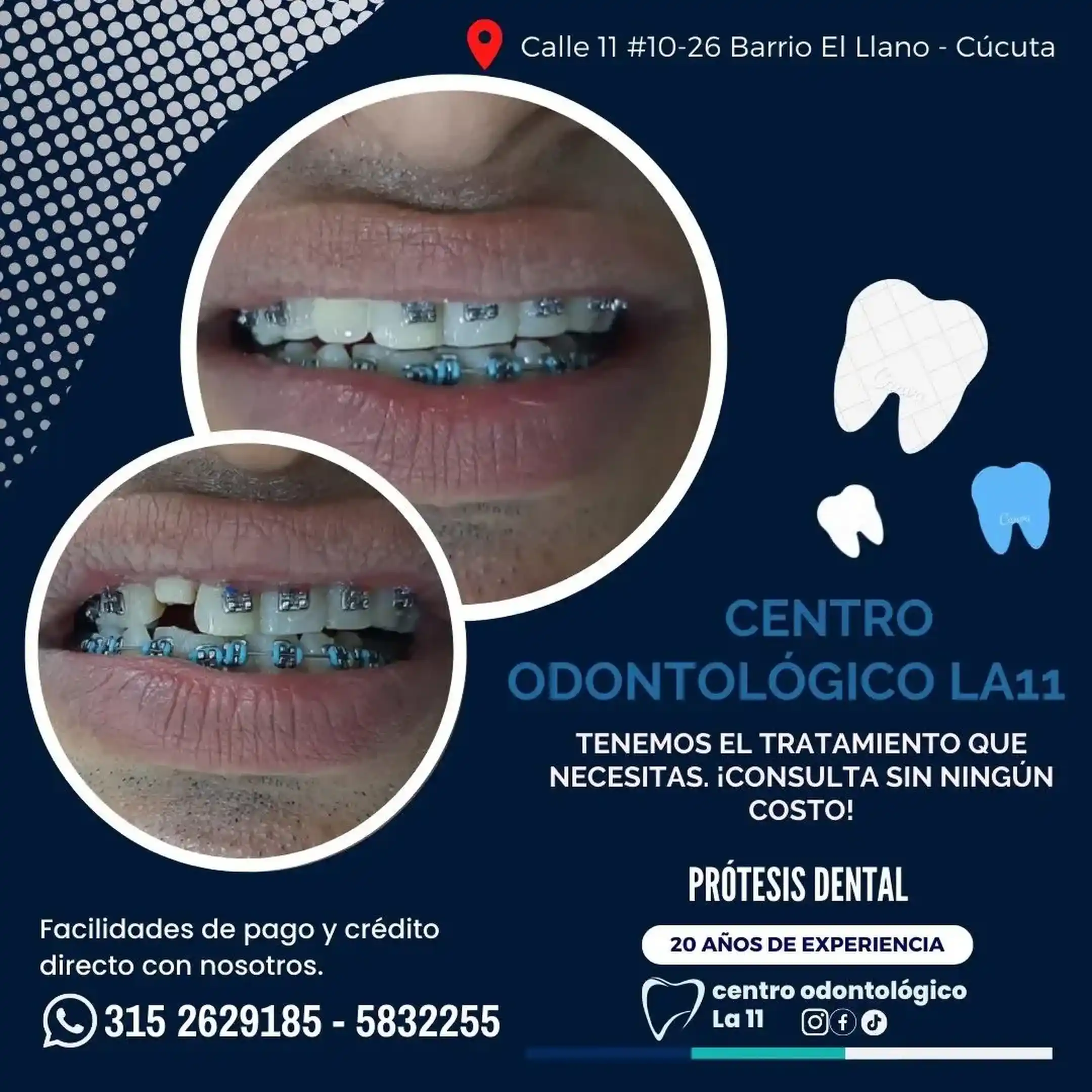 Procedimiento dental 18