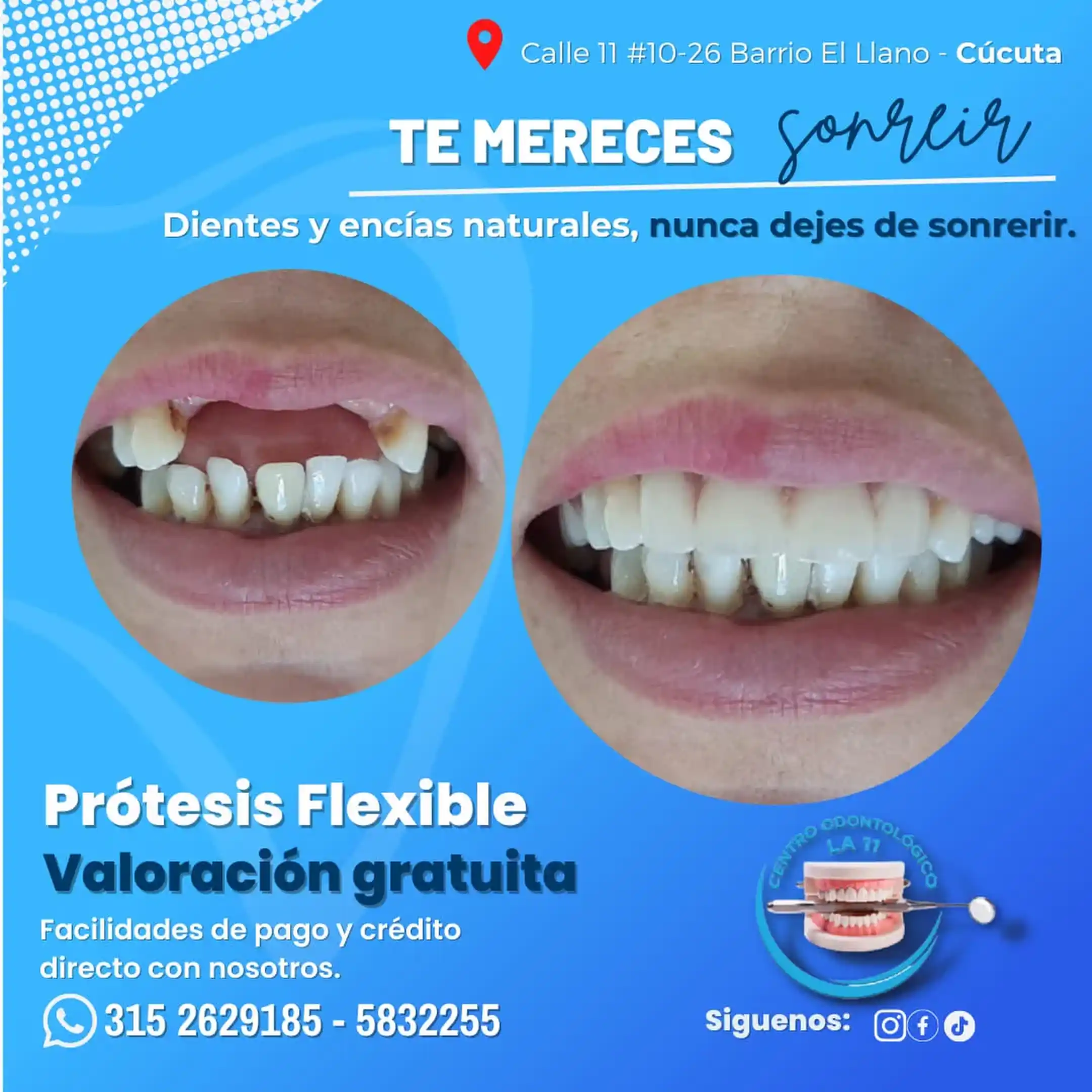 Procedimiento dental 22