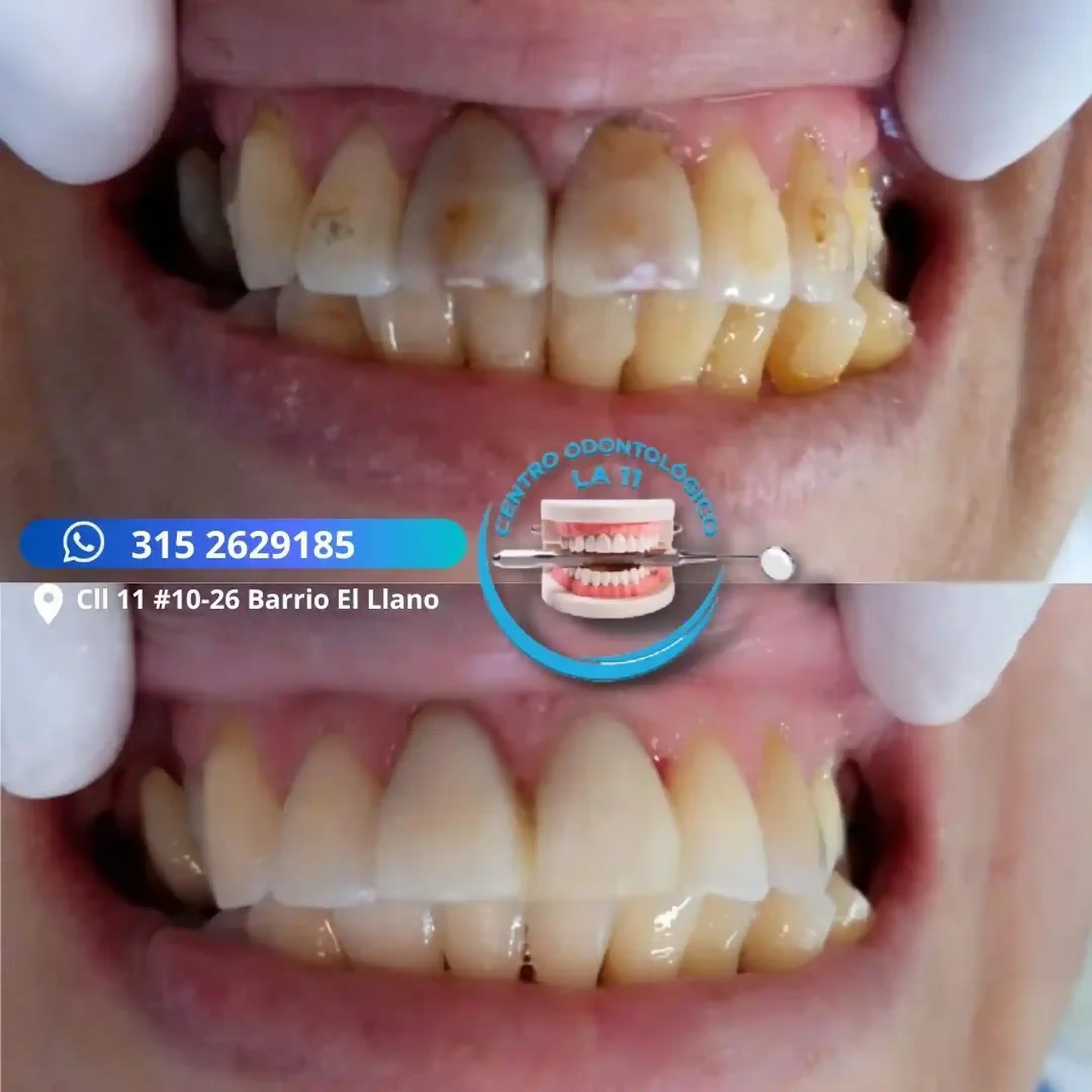 Procedimiento dental 23