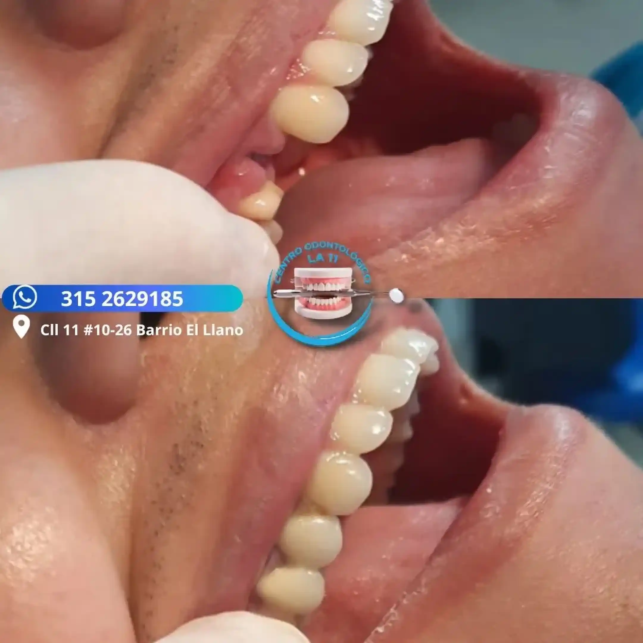 Procedimiento dental 27