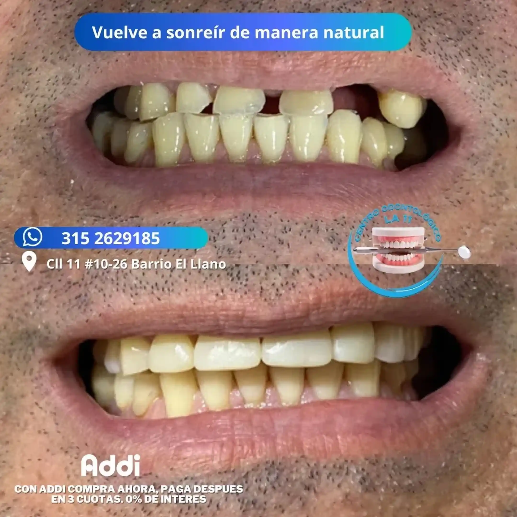 Procedimiento dental 7