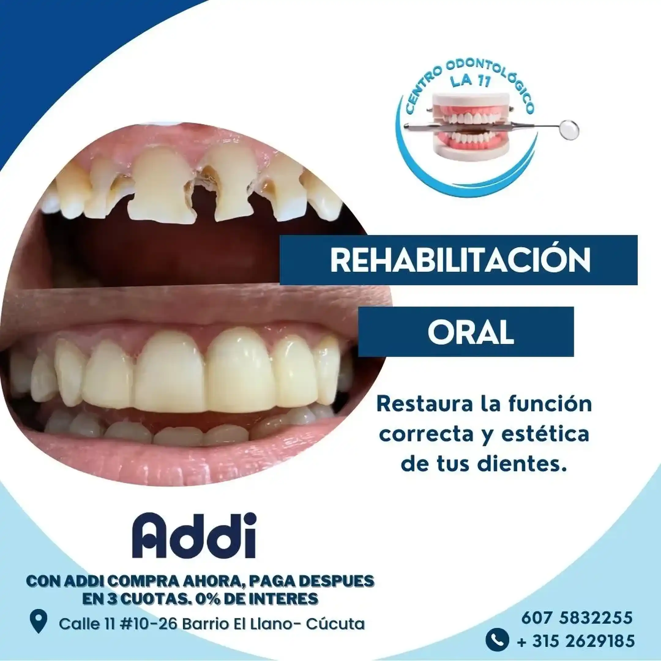 Procedimiento dental 32